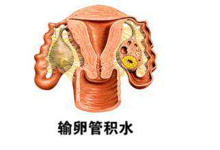 香港验血在网上可以查到吗,多次胎停遭遇怀孕难？泰国试管技术有妙招