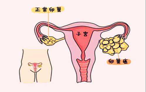 内地人去香港的诊所验血,不知不觉就怀不上了？附最全男女不孕不育排查方法