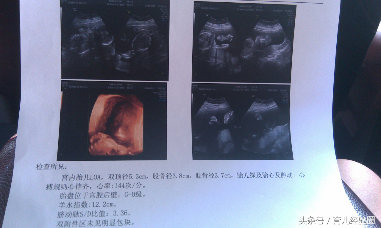 香港验血邮寄怎么伪装,头次是女儿，二胎顺利怀上儿子！终于圆了“好”梦拉