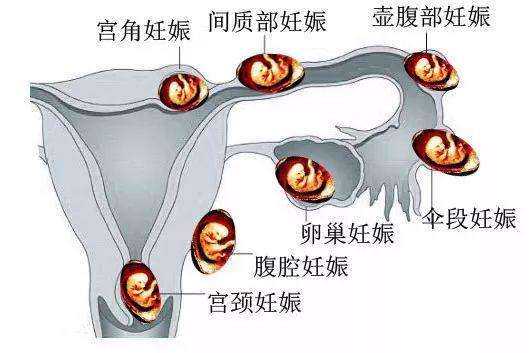 香港验血检测男女抽血,试管婴儿接近自然怀孕吗