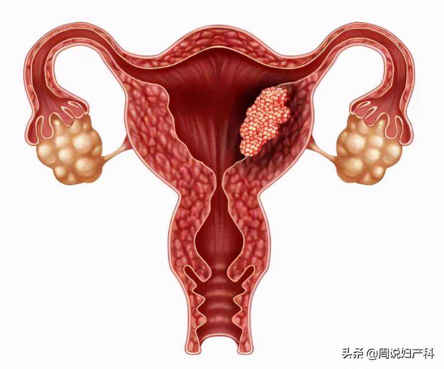 香港验血六周多有y还会变吗,43岁女性月经期子宫内膜厚度正常范围是多少mm？
