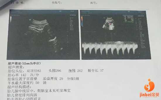 香港邮寄验血男有生女的么,【广州供卵试管机构】分享我的顺产过程（下）